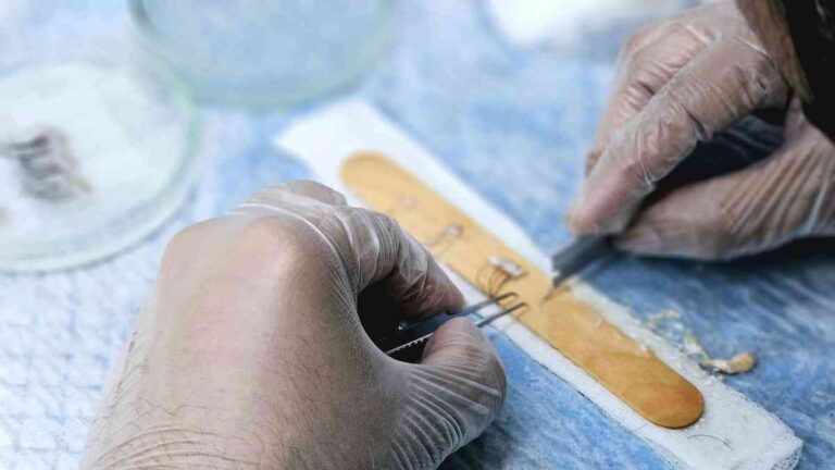 Iskrena iskustva i usporedba FUE, FUT i DHI metoda presađivanja kose