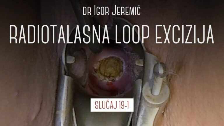 ISKUSTVA DR. IGORA JEREMIĆA